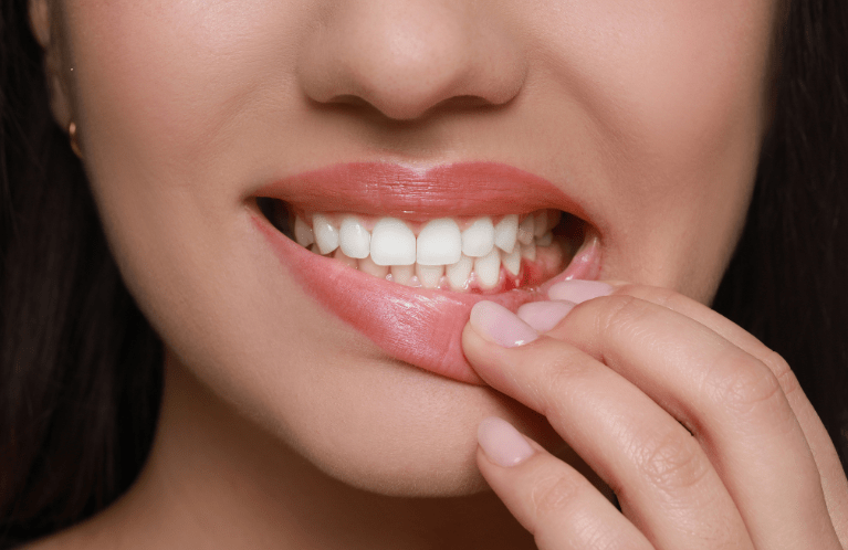 Gum disease