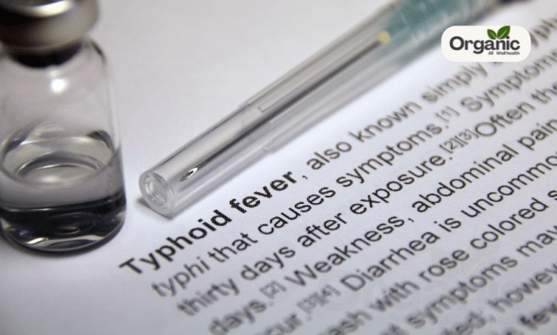 Typhoid Fever