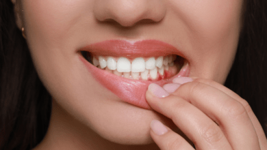 Gum disease