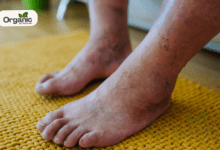 Diabetes Symptoms in Legs All Wellhealthorganic