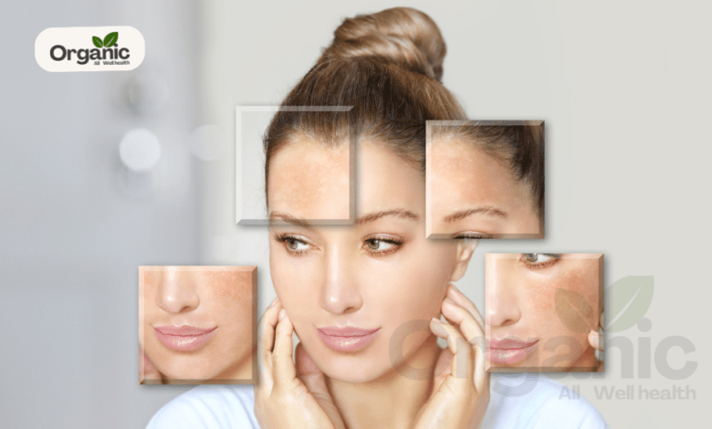 Fitkari For Skin Whitening