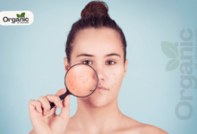 How to Prevent Acne | All Well Health Organic