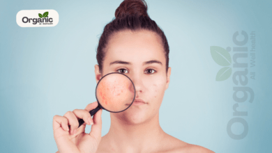 How to Prevent Acne | All Well Health Organic