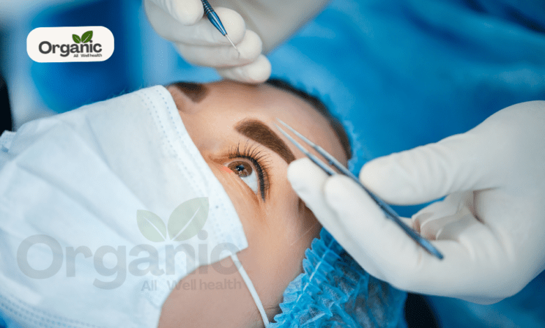 How Long Does LASIK Last?