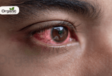 Pink Eye