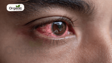 Pink Eye