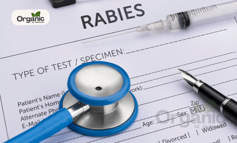 Rabies Symptoms All Well Health Organic