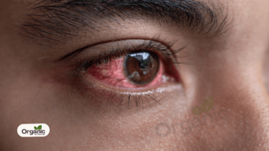 5 effective home remedies to get rid of red eyes Allwellhealthorganic