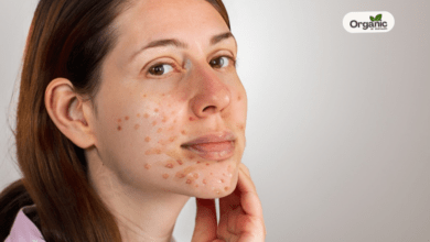 Aspirin Could Lower Skin Cancer Risk Allwellhealthorganic