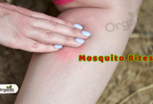 Avoid Painful Mosquito Bites Allwellhealthorganic