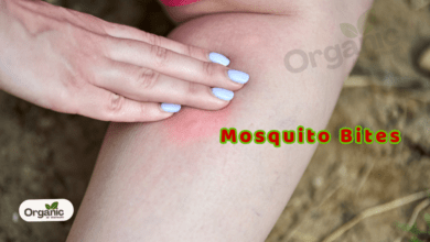 Avoid Painful Mosquito Bites Allwellhealthorganic