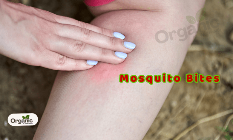 Avoid Painful Mosquito Bites Allwellhealthorganic