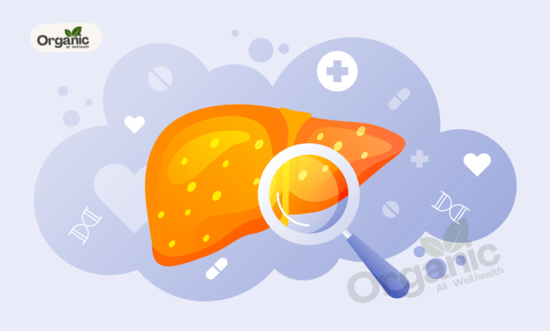 Fatty Liver Diseases Allwellhealthorganic