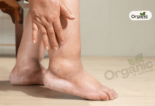 Home Remedies To Treat Swollen Feet Allwellhealthorganic