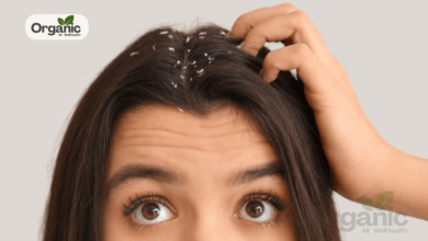 Dandruff In Winter Solutions Allwellhealthorganic