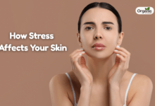 How Stress Affects Your Skin Allwellhealthorganic
