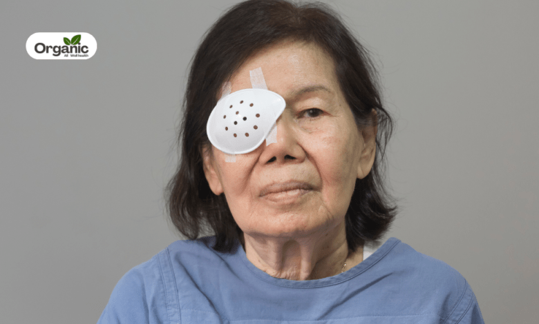 Cataract Surgery Recovery Tips Allwellhealthorganic