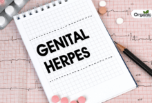 Genital herpes Allwellhealthorganic