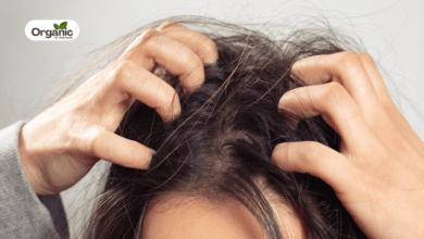 Itchy Scalp Allwellhealthorganic