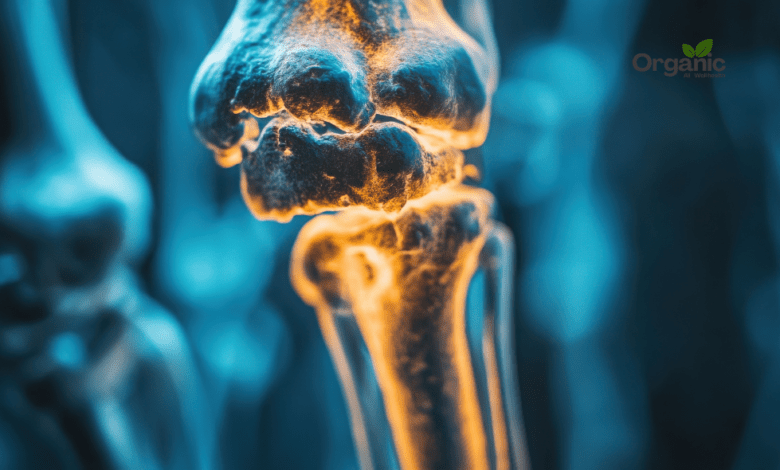 Bone Health Allwellhealthorganic