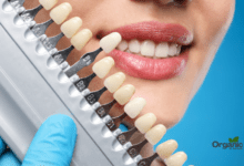 Cosmetic Dentistry Allwellhealthorganic