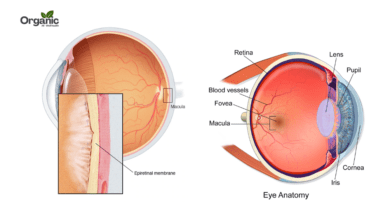 Epiretinal Membrane क्या है Allwellhealthorganic