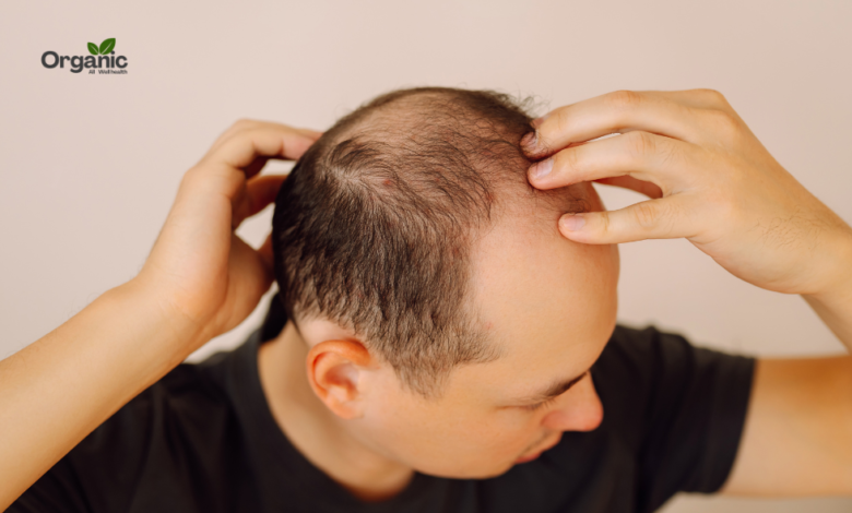 Hair Loss Allwellhealthorganic