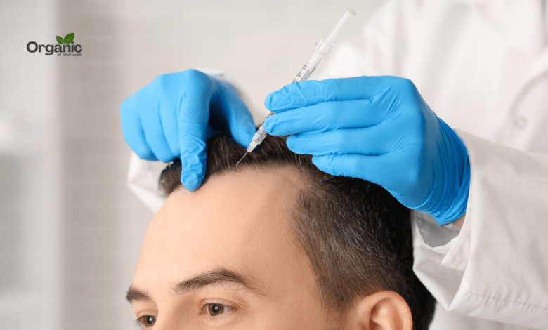 Hair Transplants Allwellhealthorganic