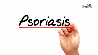 Psoriasis Symptoms Allwellhealthorganic