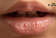 Struggling With Dry Mouth Allwellhealthorganic