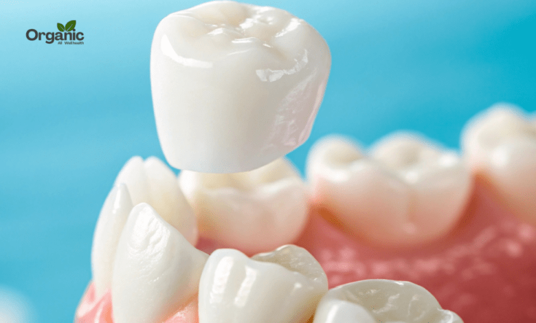 Temporary Dental Crown Allwellhealthorganic