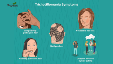 Trichotillomania Allwellhealthorganic