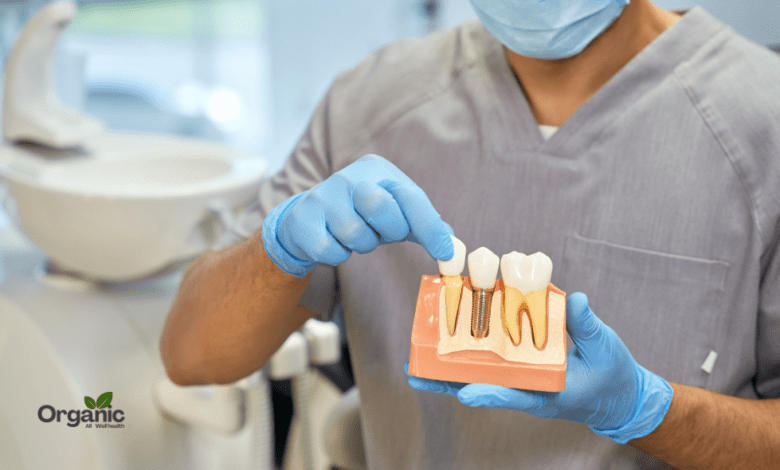 What People Commonly Understand About Dental Implants Allwellhealthorganic