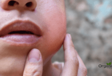 Wisdom Teeth Swelling स्वस्थ दांत और मसूड़ों के लिए सम्पूर्ण मार्गदर्शिका Allwellhealthorganic