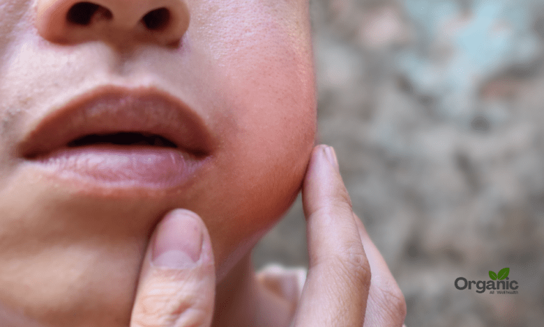 Wisdom Teeth Swelling स्वस्थ दांत और मसूड़ों के लिए सम्पूर्ण मार्गदर्शिका Allwellhealthorganic