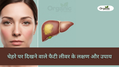 Fatty Liver Symptoms on the Face Allwellhealthorganic