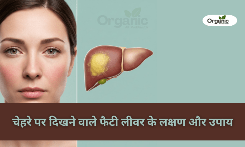 Fatty Liver Symptoms on the Face Allwellhealthorganic