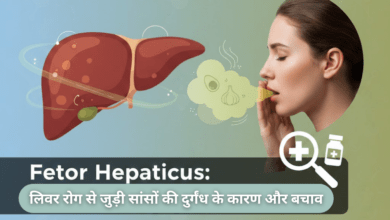 Fetor Hepaticus Allwellhealthorganic