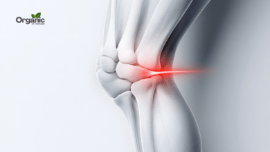 Osteoarthritis Allwellhealthorganic