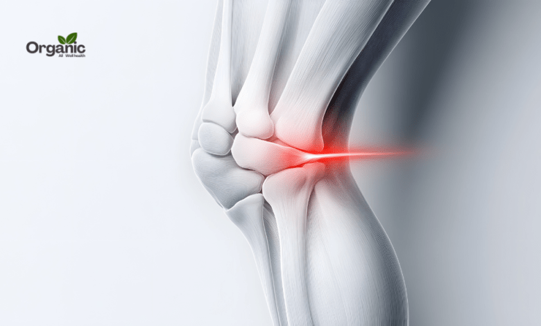 Osteoarthritis Allwellhealthorganic