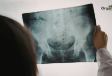 Pelvic Pain पेल्विक दर्द Allwellhealthorganic