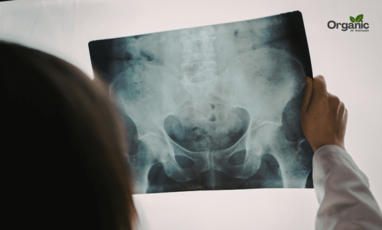 Pelvic Pain पेल्विक दर्द Allwellhealthorganic