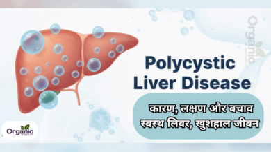Polycystic Liver Disease Healthy life Wellhealthorganic Allwellhealthorganic Lifestyle