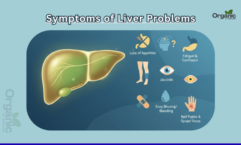 Symptoms of Liver Problems Healthy life Wellhealthorganic Allwellhealthorganic Lifestyle