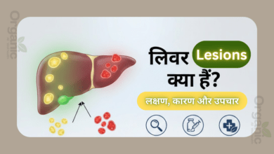 What Are Liver Lesions Healthy life Wellhealthorganic Allwellhealthorganic Lifestyle