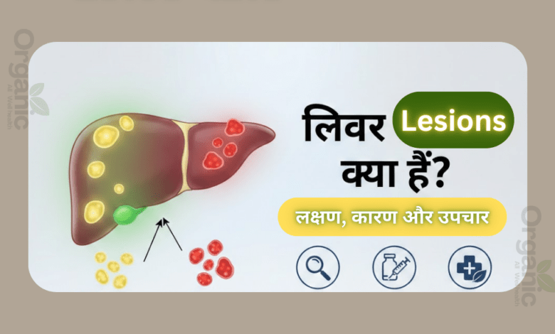 What Are Liver Lesions Healthy life Wellhealthorganic Allwellhealthorganic Lifestyle
