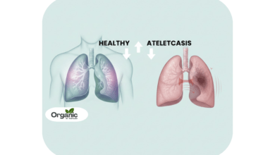 Atelectasis Allwellhealthorganic