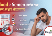 Blood in Semen Allwellhealthorhanic.com wellhealthorganic.com Best Health tips Health Tips