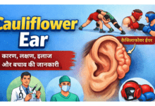 Cauliflower Ear Allwellhealthorhanic.com wellhealthorganic.com Best Health tips Health Tips