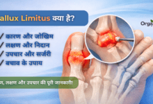 Hallux Limitus Allwellhealthorhanic.com wellhealthorganic.com Best Health tips Health Tips
